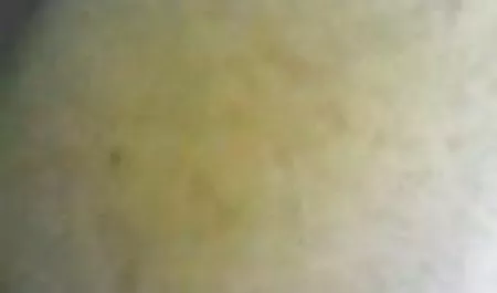 یک عکس دختر و پسر سکسی پزشک چربی یک دختر جوان را معاینه کرد